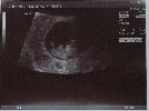 2004-07-23_16-15-18_scan.jpg